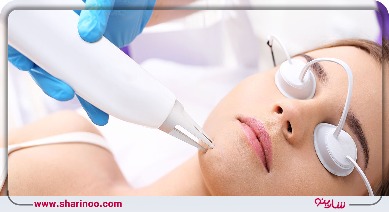 قیمت لیزر در سنندج