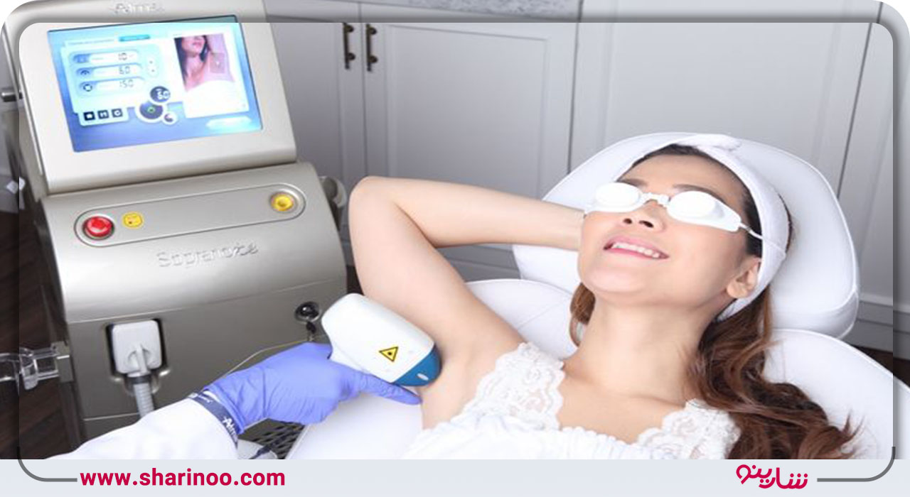 لیزر صورت در سنندج