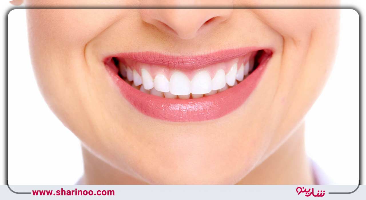 خدمات زیبایی دندان