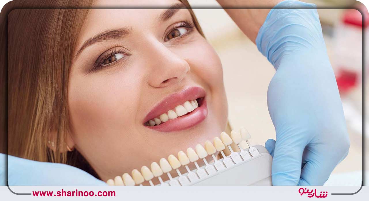 کامپوزیت دندان