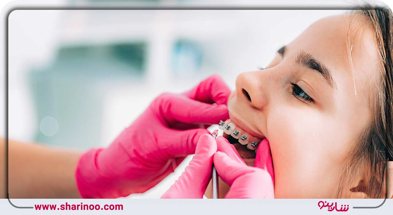 تعرفه دندانپزشکی در همدان
