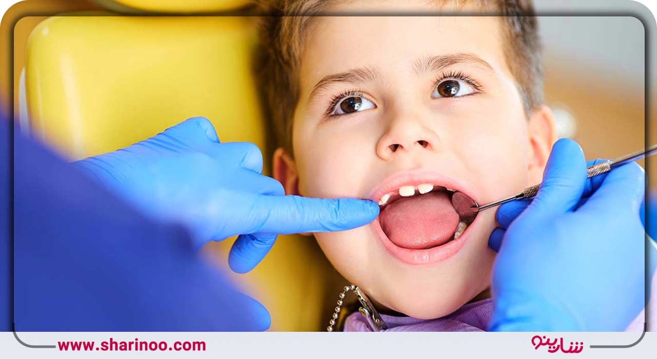 باندینگ دندان