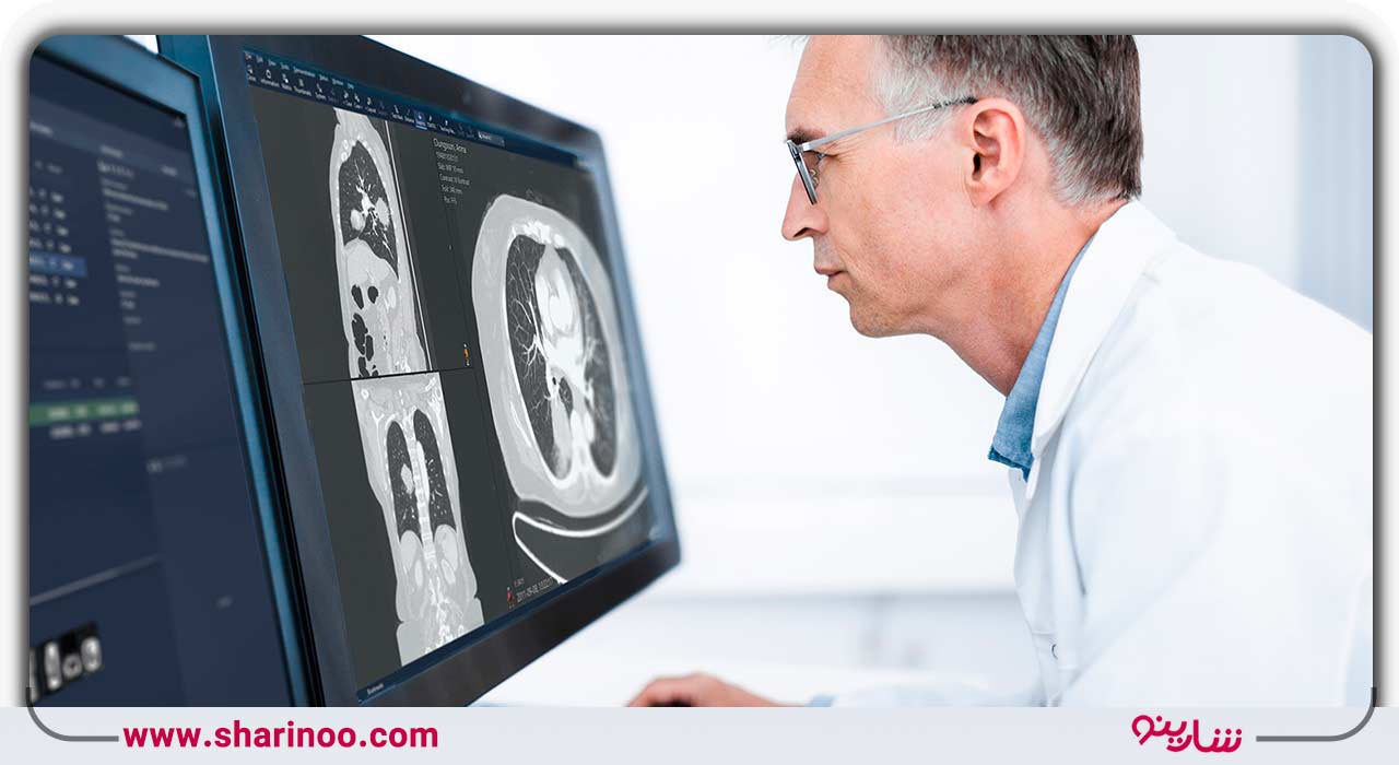 رادیولوژی در همدان