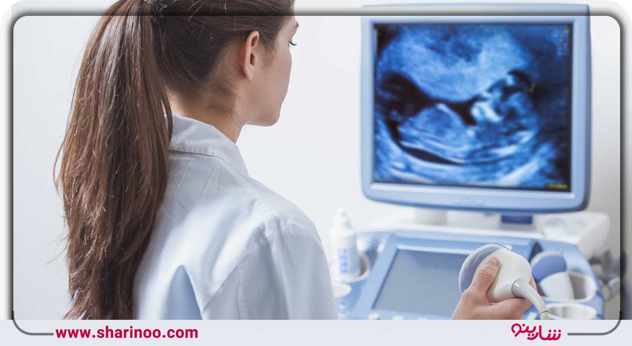 لیست سونوگرافی‌های همدان