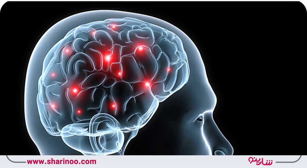 پزشک مغز و اعصاب کیست؟