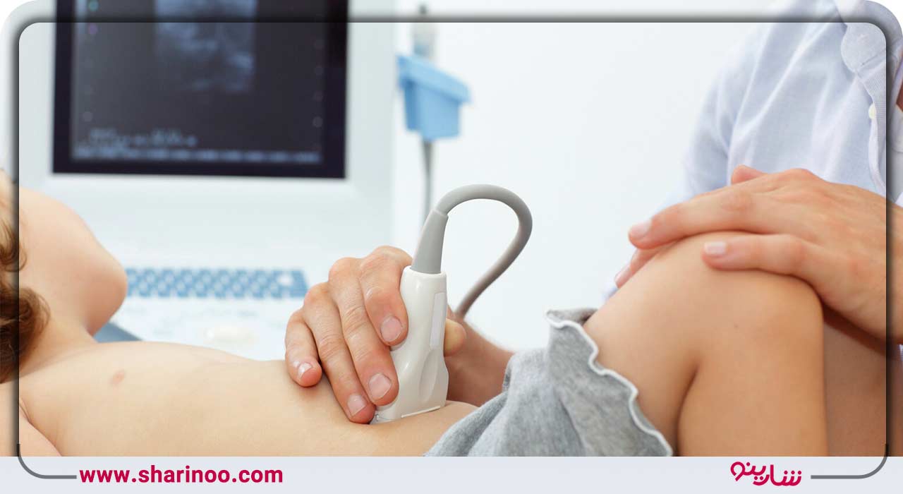 انواع سونوگرافی
