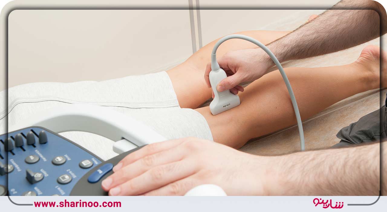 آمادگی پیش از سونوگرافی داپلر رنگی عروق