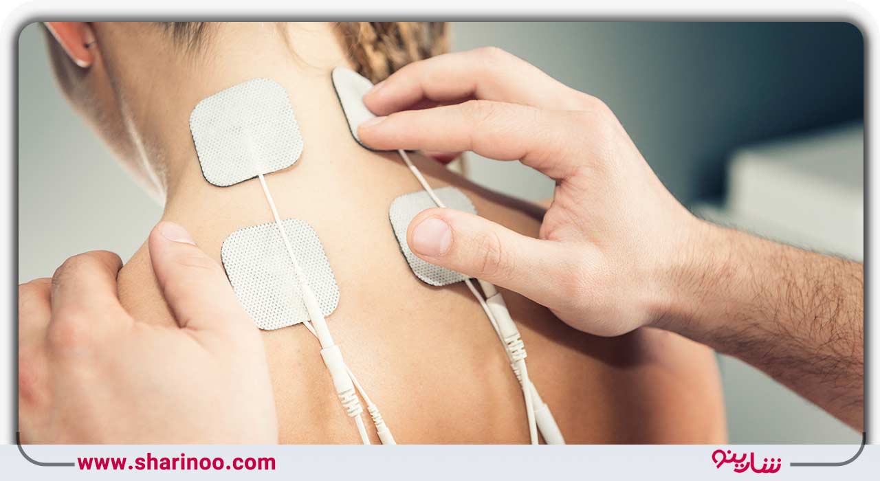 تحریک الکتریکی