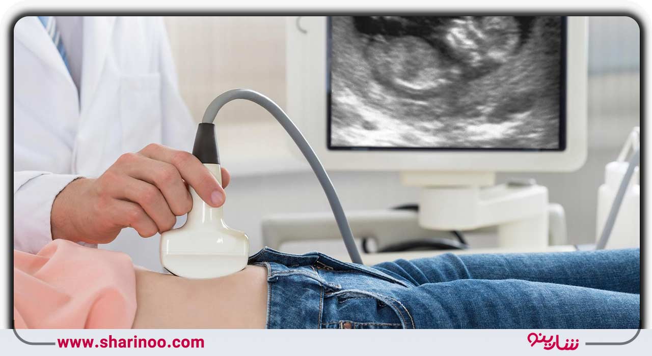 پزشک زنان در اصفهان