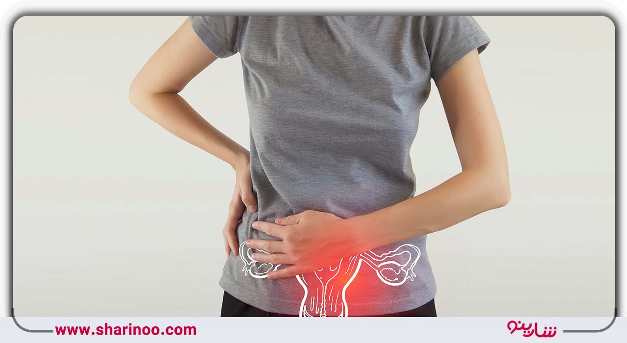 بستن لولههای رحم در یزد