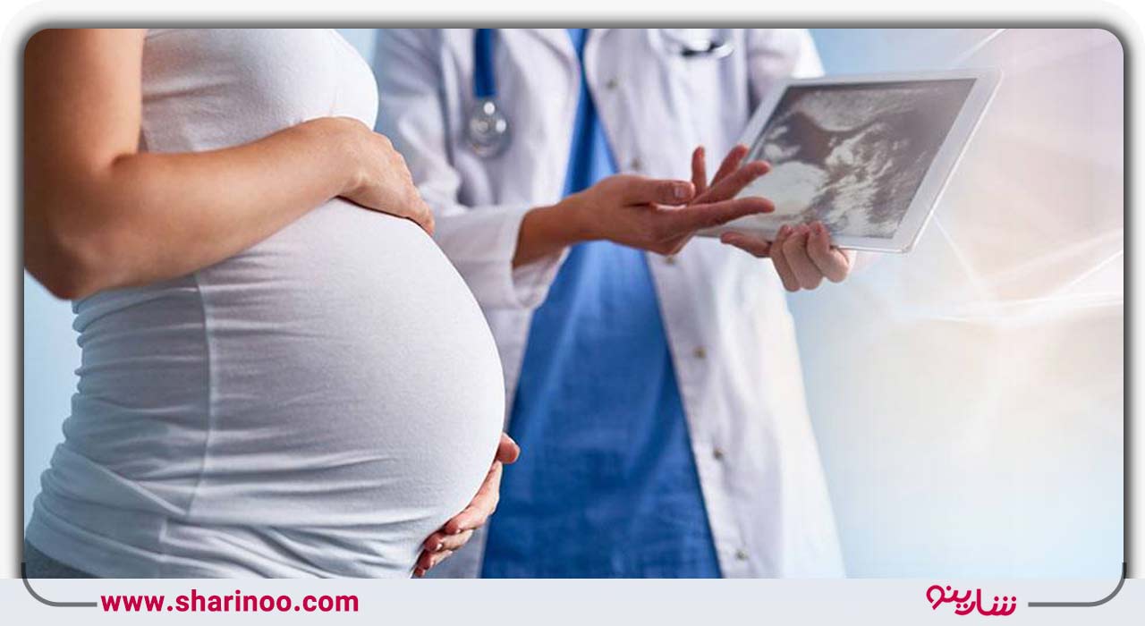 تست پاپ اسمیر در یزد