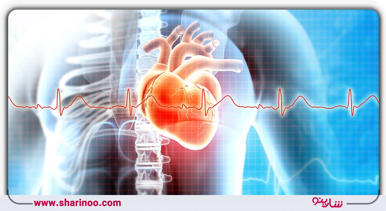 فوق تخصص قلب در اصفهان- سطح B نارسایی قلبی