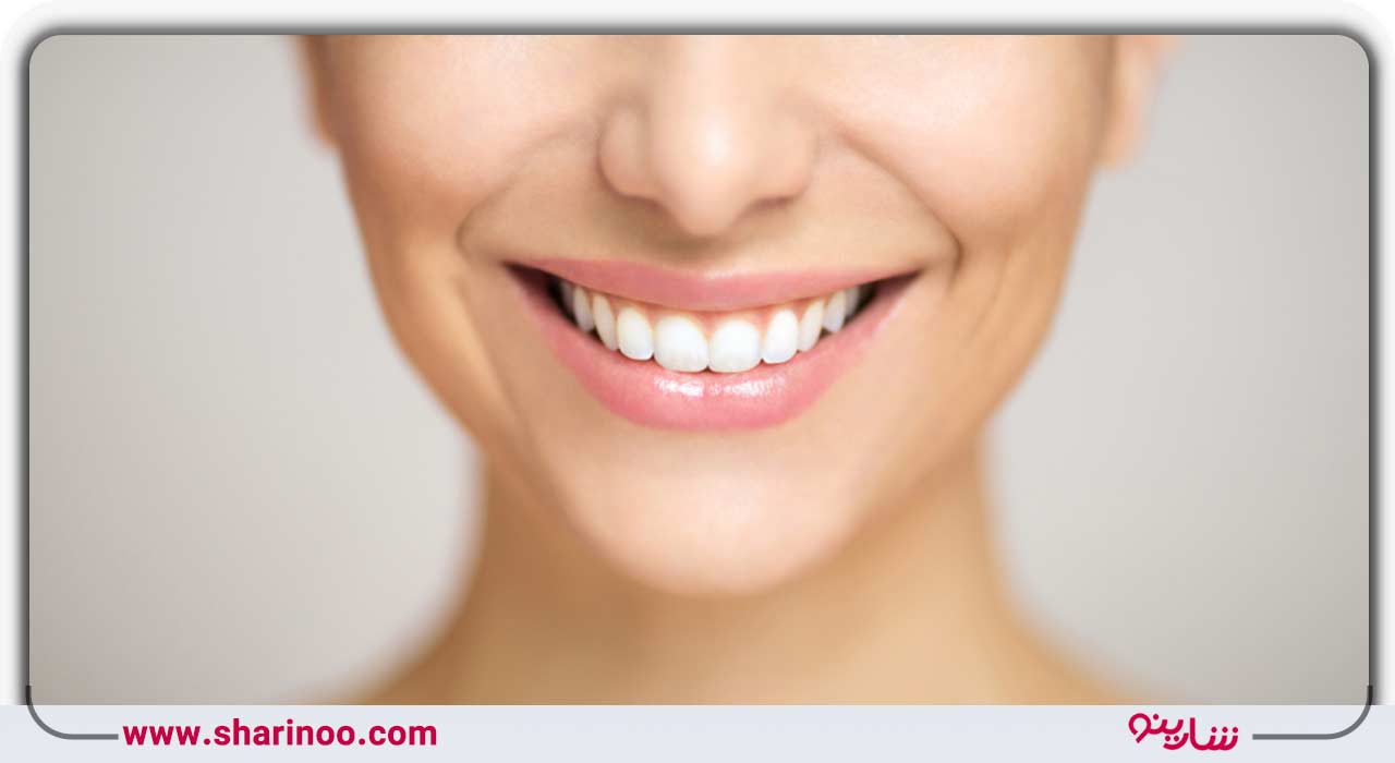 خدمات زیبایی د‌هان و دندان