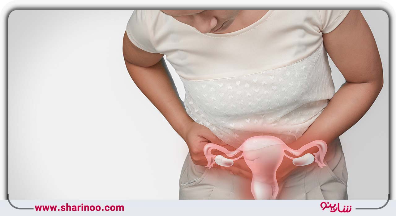 بهترین پزشکان زنان و زایمان در یزد- درمان سرطان رحم در یزد