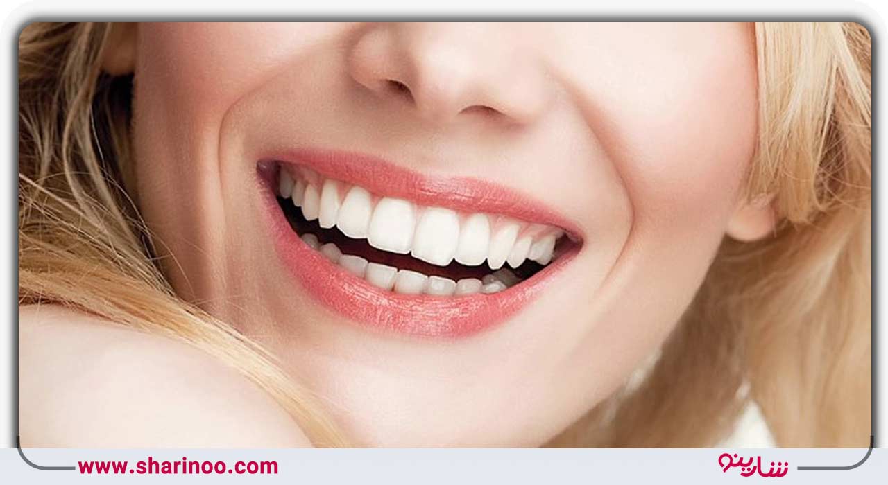 وایتینگ دندان