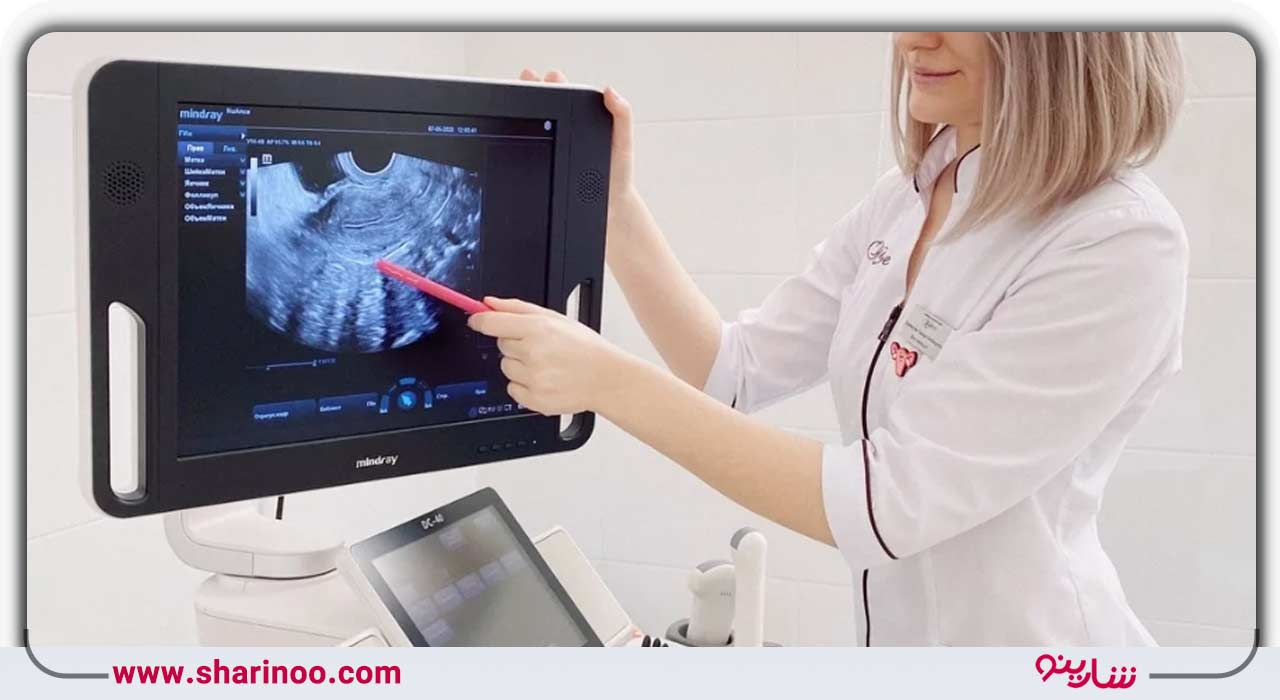 آمادگی‌های قبل از سونوگرافی