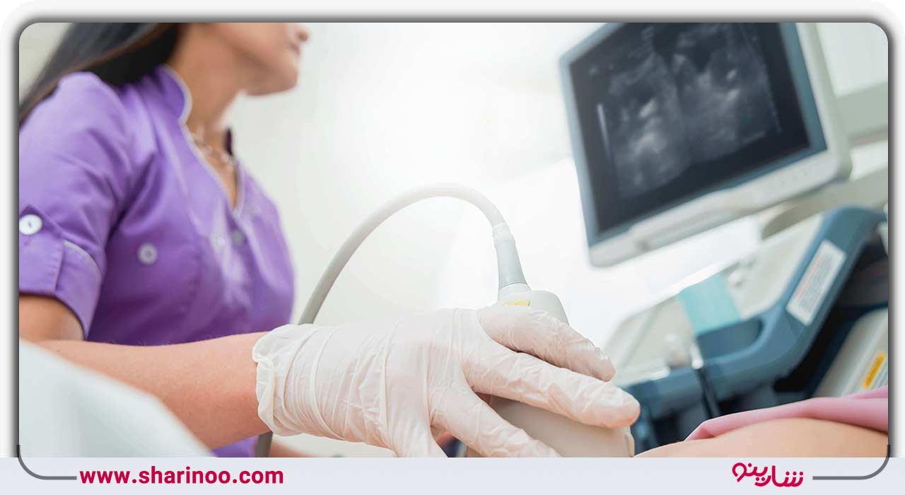 سؤالات متداول