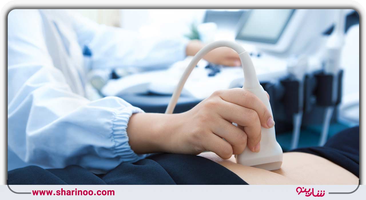 سونوگرافی در یزد