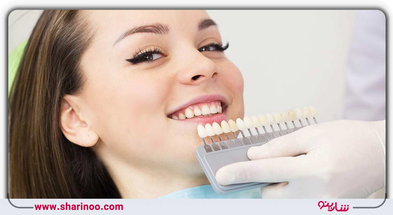 باندینگ دندان