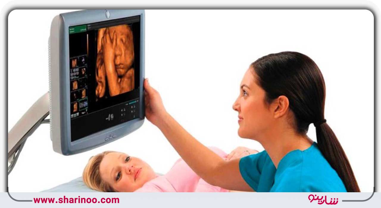 سونوگرافی سه بعدی