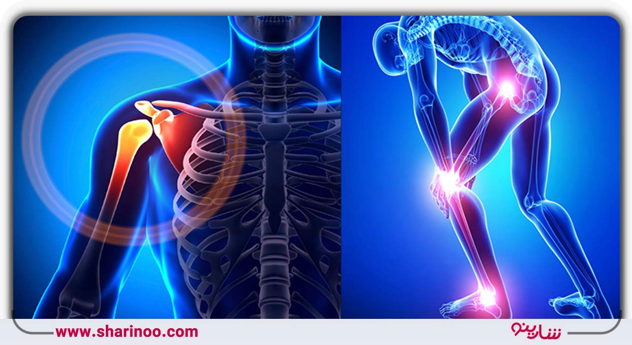بهترین پزشک ارتوپد در اصفهان