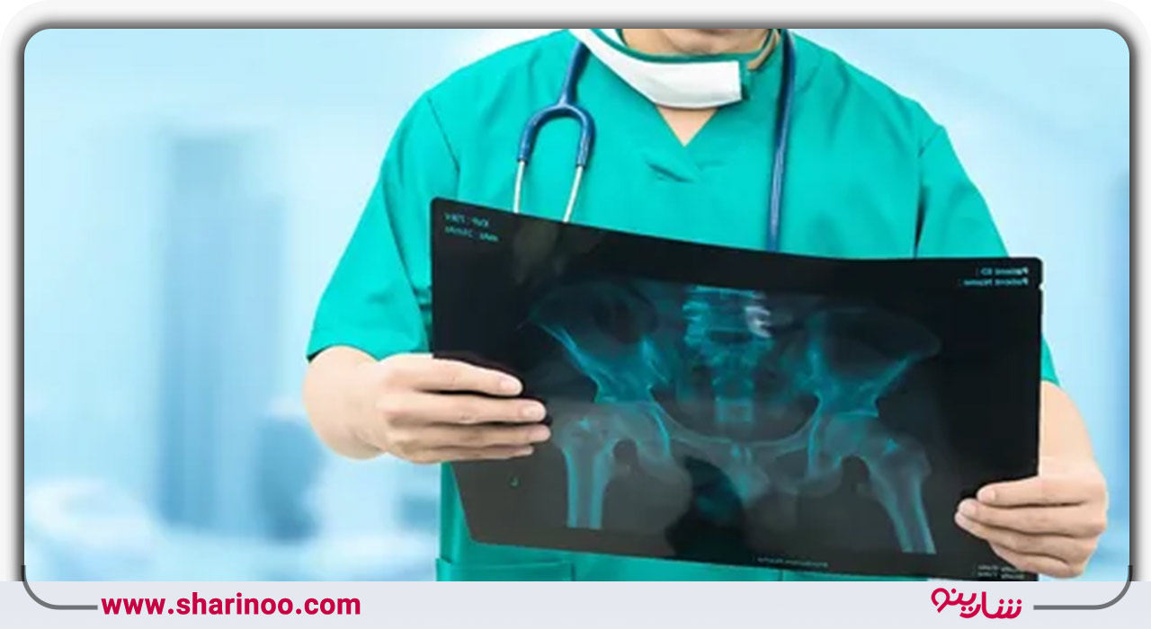 بهترین پزشک ارتوپد در اصفهان