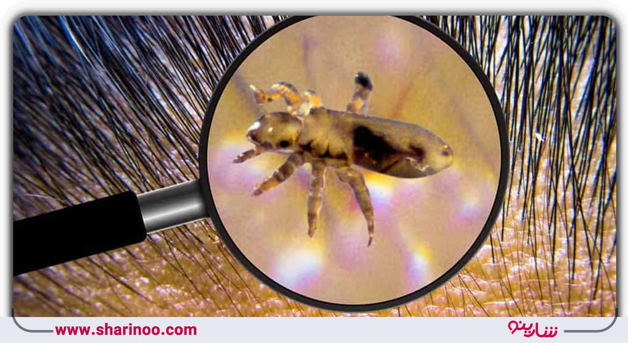 سمپاشی با سمهای کم خطر و بدون ضرر در اصفهان