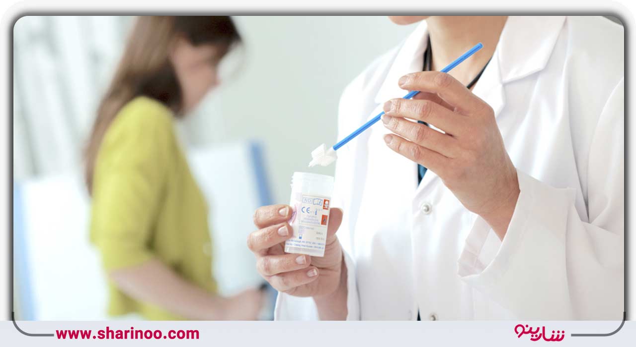 آزمایش پاپ اسمیر