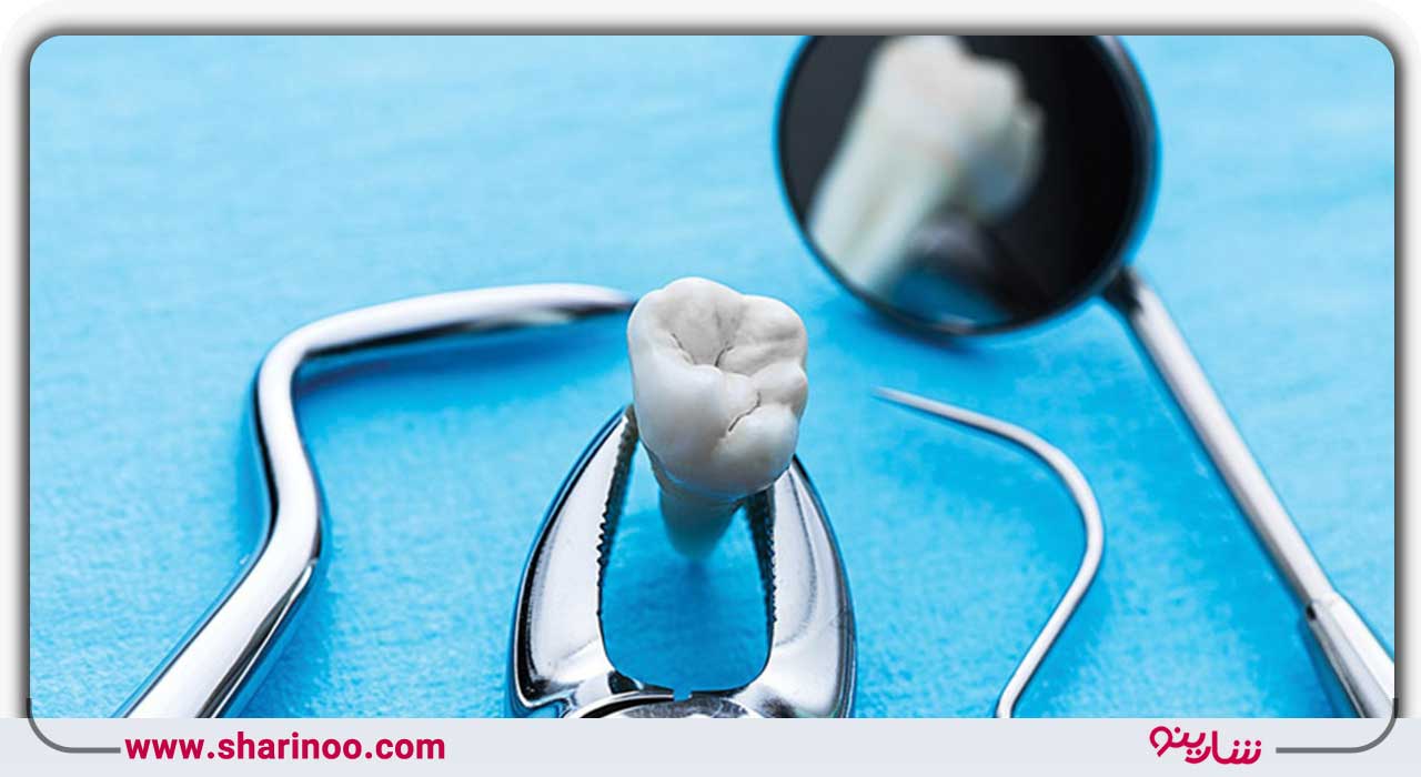 کشیدن دندان