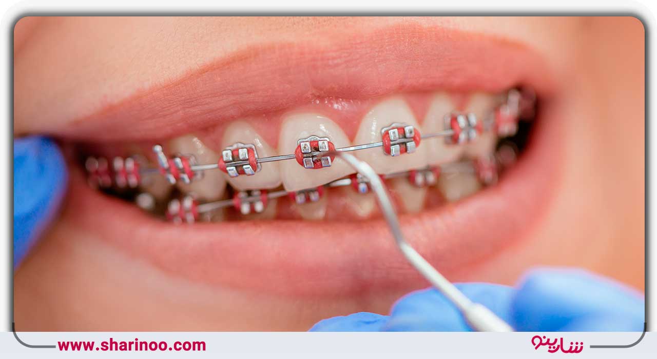 متخصص ارتودنسی در اصفهان