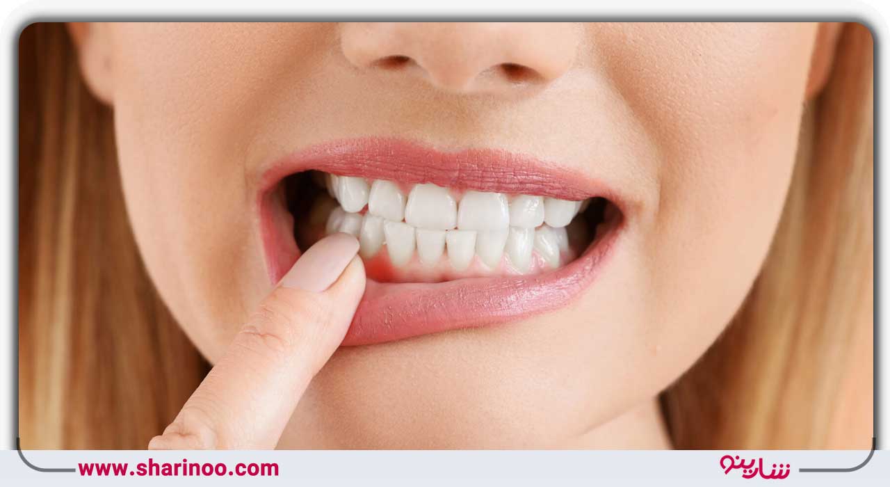 متخصص ترمیم و زیبایی دندان در اصفهان