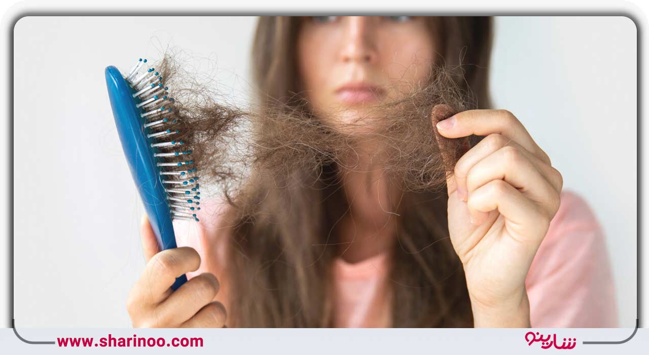 ریزش مو