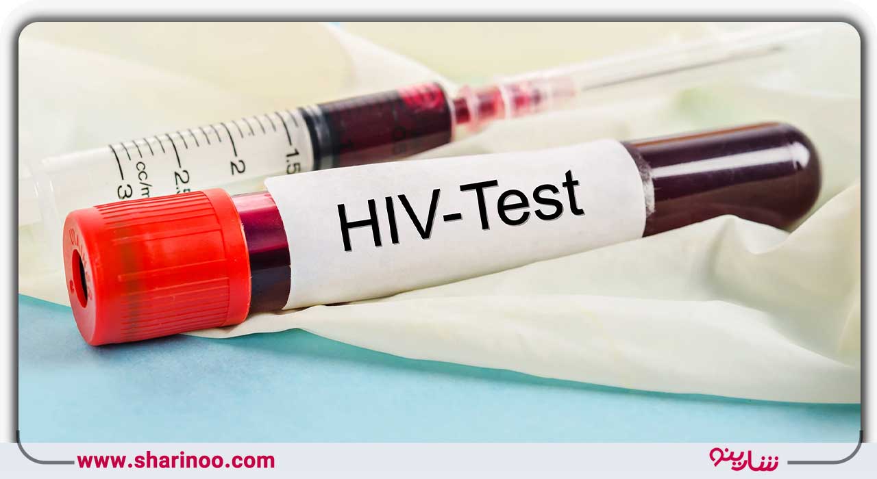 آزمایش ایدز (HIV)