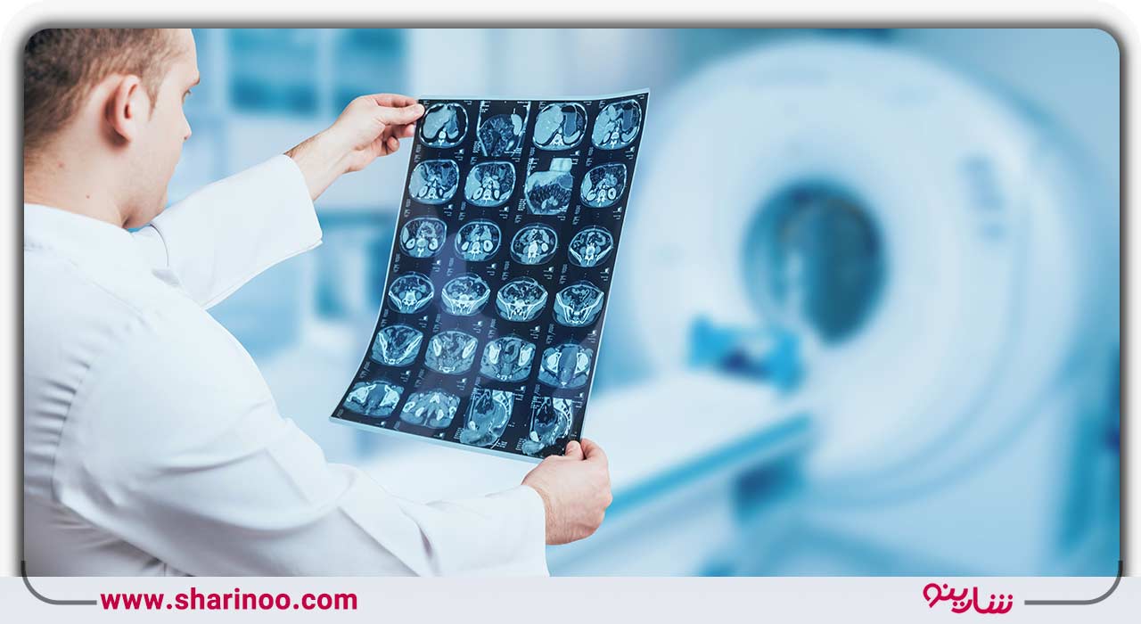 رادیولوژی چیست و چگونه انجام می‌شود؟