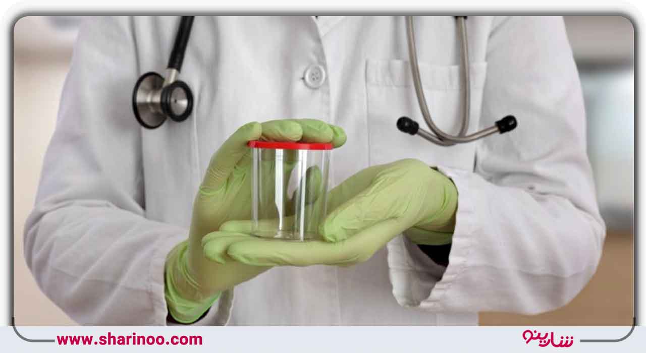 ویژگی‌های شیمیایی ادرار