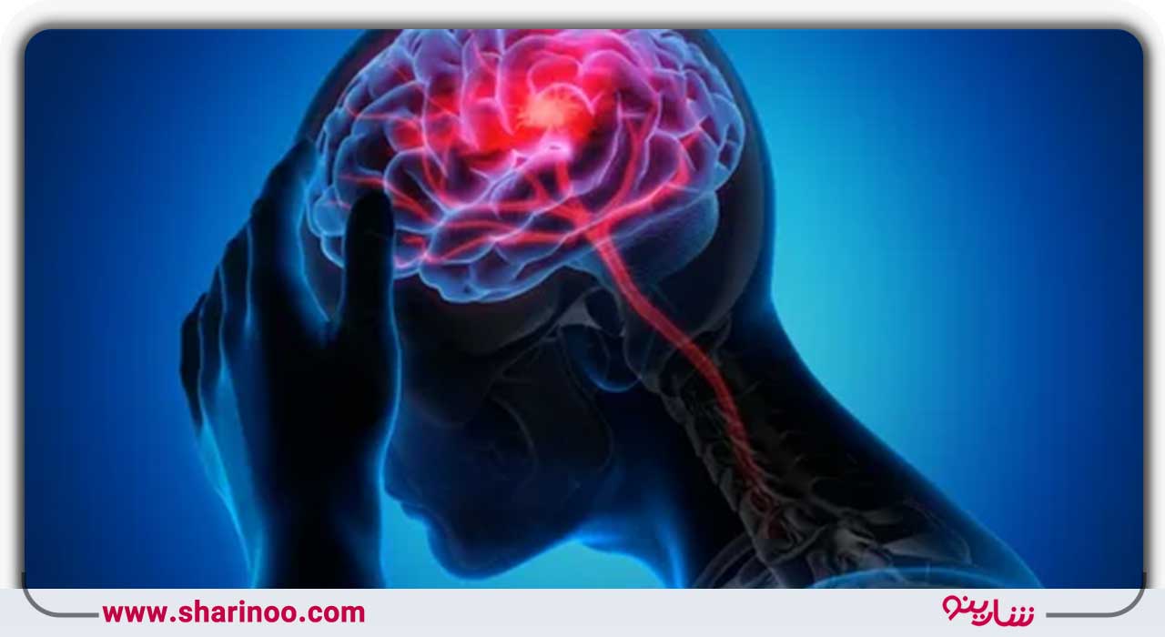 بهترین رادیولوژیست در اصفهان