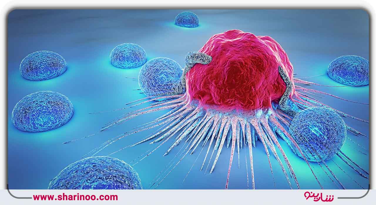 درمان سرطان در اصفهان