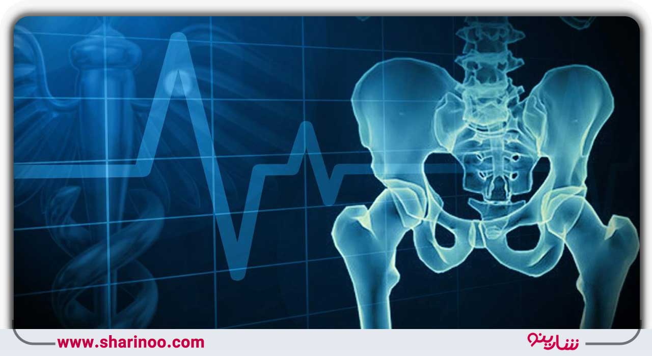 اسکن استخوان در اصفهان