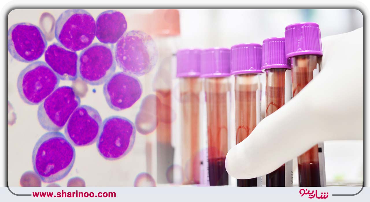 آزمایشگاه های یزد تست سرطان خون