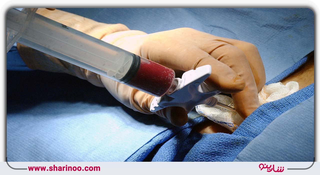 آزمایش‌های قبل ازدواج شامل آزمایش اعتیاد، خون، معاینه مربوط به توانایی فرزندآوری و ارزیابی سلامت عمومی‌