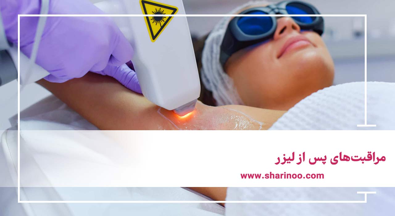 مراقبت‌های پس از لیزر