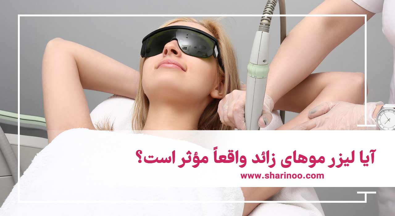 لیزر مو‌های زائد