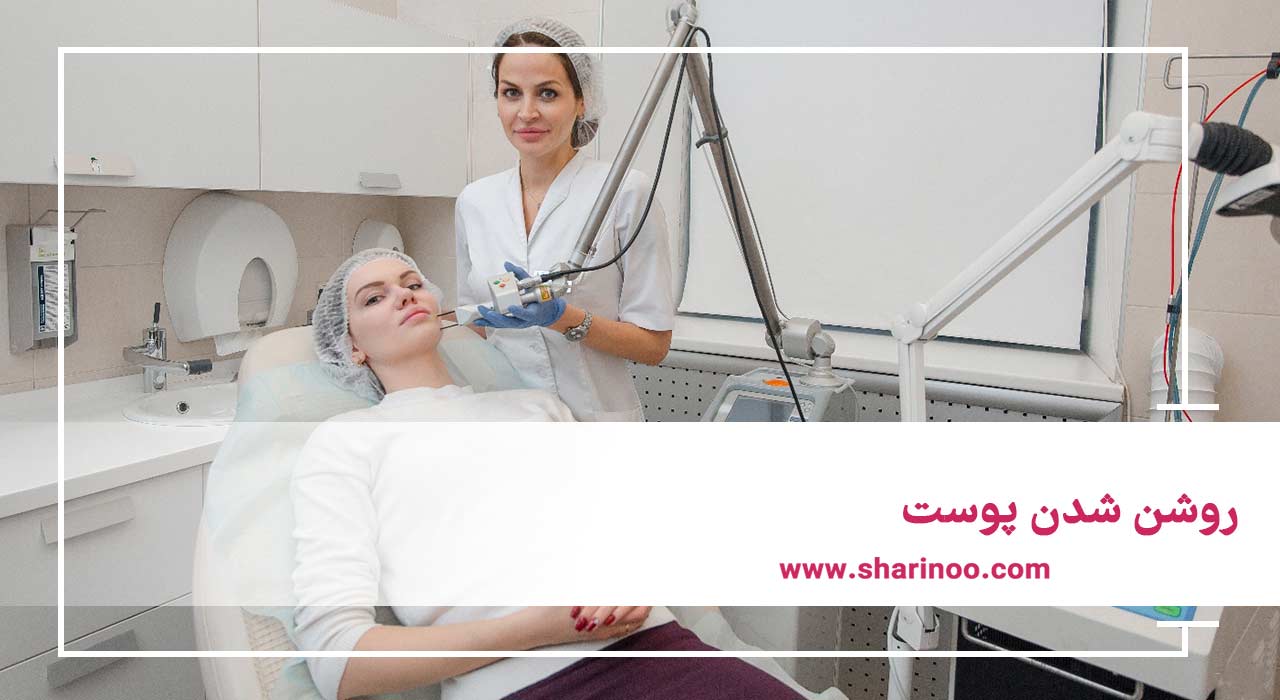 مزایای لیزر مو‌های زائد