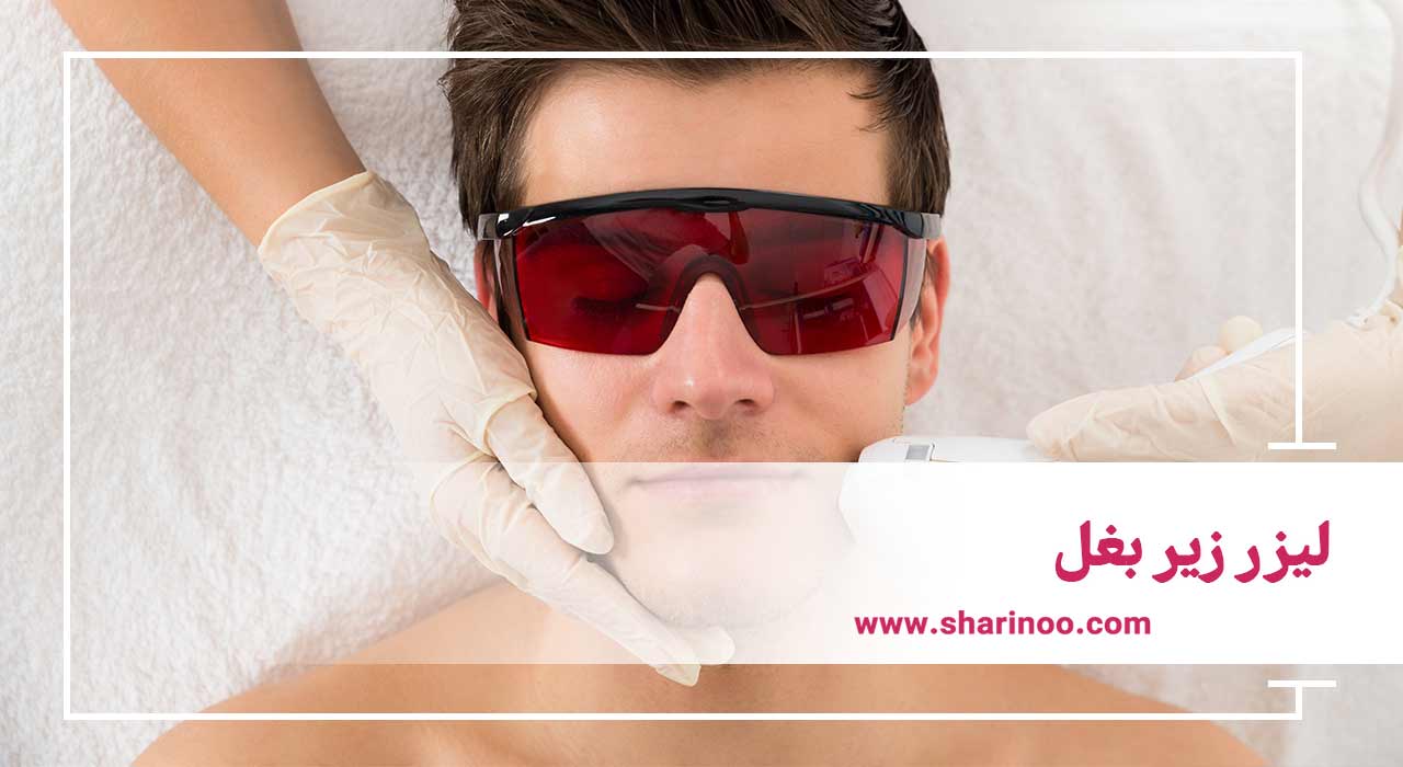 لیزر زیر بغل