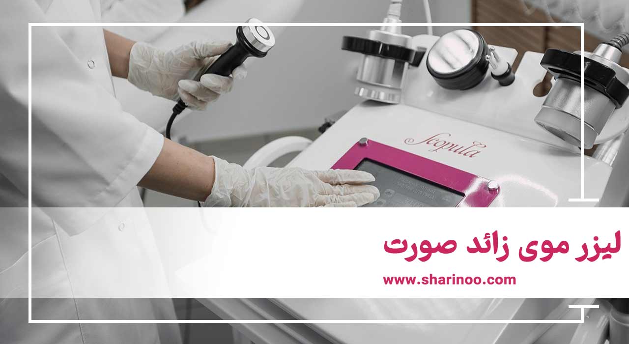 لیزر موی زائد صورت