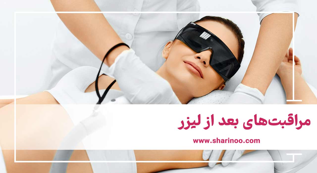 مراقبت‌های بعد از لیزر